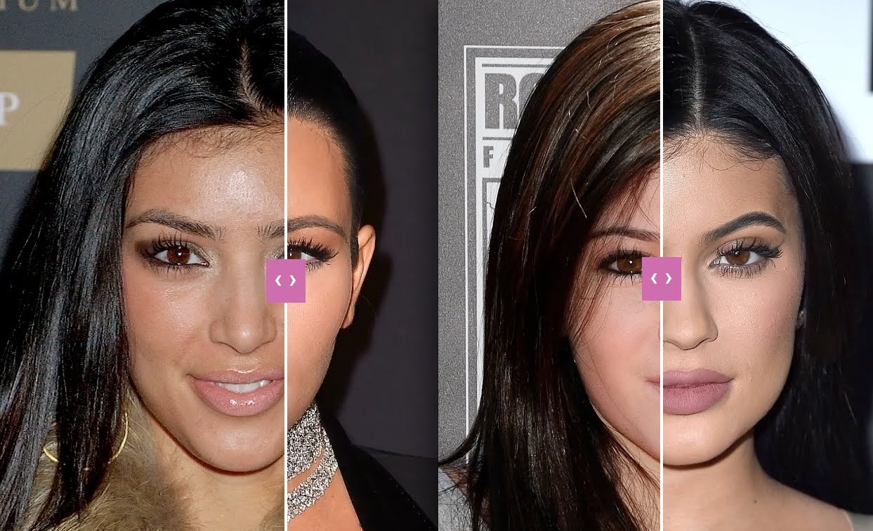 kim-kardashian-before-plastic-surgeon-1.jpg